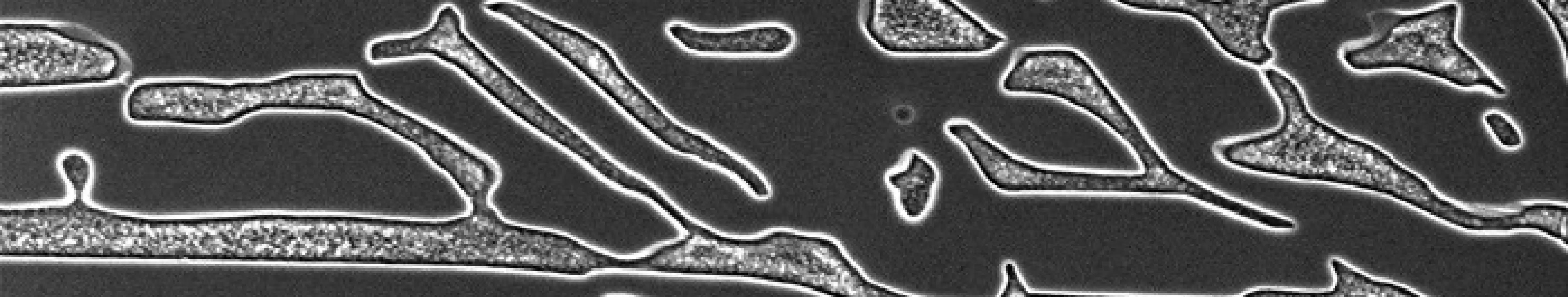 المجاهر الإلكترونية الماسحة من Tescan لعلوم المواد