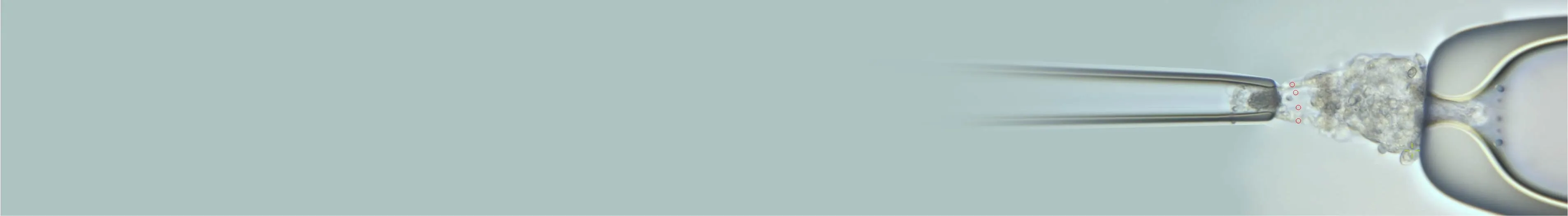 Hamilton Thorne LYKOS Clinical laser